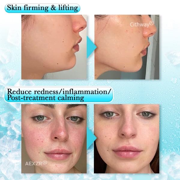 Aexzr® Anti-swelling Gel Beads Facial Therapy Mask