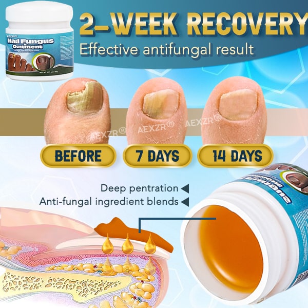 Aexzr® 5X Quick-healing Nail Fungus Ointment