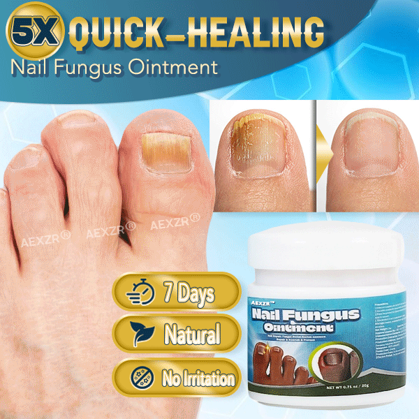 Aexzr® 5X Quick-healing Nail Fungus Ointment