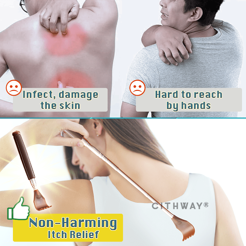 Cithway® Easy-Reach Telescopic Back Scratcher